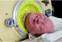 The death of Paul Alexander who spent 70 years inside the iron lung
