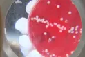 Increase in syphilis cases in Montreal