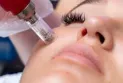 Three women infected with the HIV virus after undergoing a "vampire facial" procedure at a spa in New Mexico.