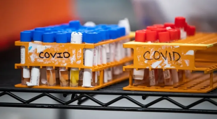 Ontario ends wastewater monitoring program tracking COVID-19 infections.