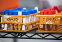 Ontario ends wastewater monitoring program tracking COVID-19 infections.