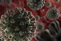Le Canada annonce une épidémie de listériose dans le pays