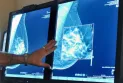 Ontario: New, breast imaging starting at age 40 without a doctor's referral