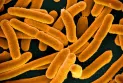 Épidémie d'infection à Escherichia coli (E. Coli) liée aux îles organiques